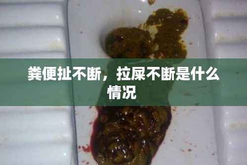 粪便扯不断,拉屎不断是什么情况